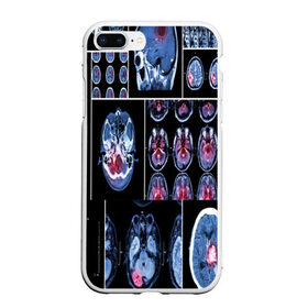 Чехол для iPhone 7Plus/8 Plus матовый с принтом неврология , Силикон | Область печати: задняя сторона чехла, без боковых панелей | 