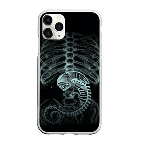 Чехол для iPhone 11 Pro матовый с принтом Чужой на Рентгене , Силикон |  | alien | больница | больной | внутренний мир | врач | клиника | кости | пациент | ребра | рентген | скелет | снимок | хищник